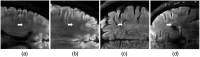 Fig. 11