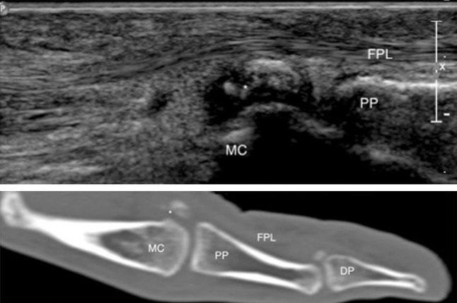 Fig. 4