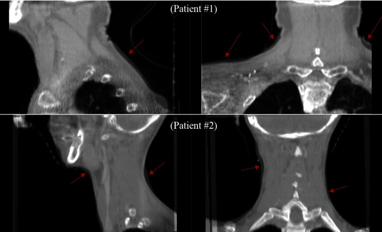 FIG. 6.