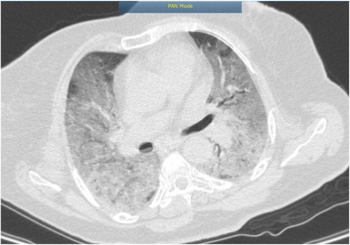 Fig. 1b