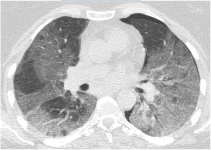 Fig. 1c