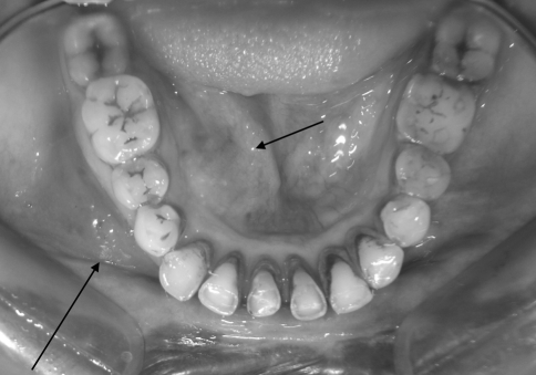 Fig. 1