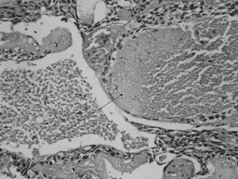 Fig. 4