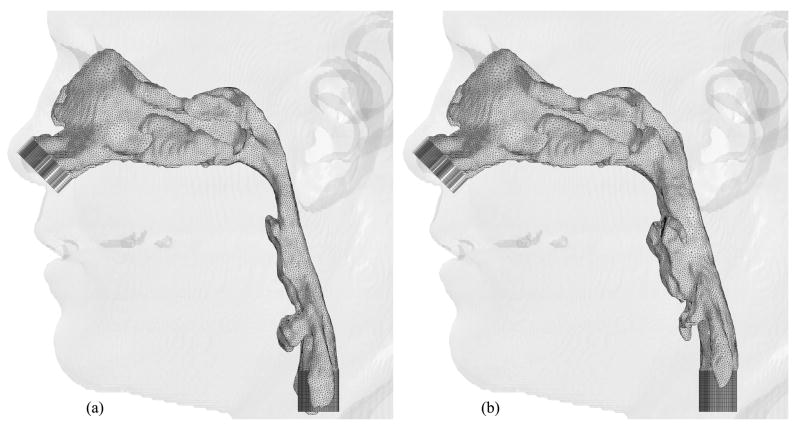 Fig. 15