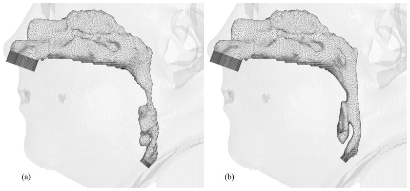 Fig. 11