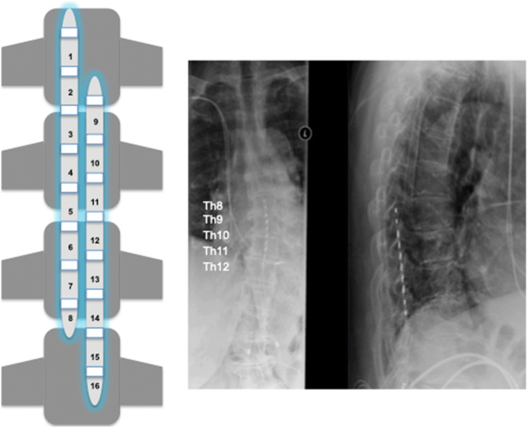 Fig. 1