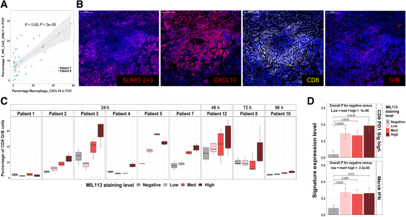 Figure 5. Presence of CXCL10 macrophages correlates with an increase in localized recruitment of cytotoxic immune cells. A, Correlation of the percentage of T, NK, and granulolysin (GNLY)-positive cells in CosMx FOVs to the percentage of Macrophage_CXCL10 cells. A linear model fit is shown with associated Pearson correlation, and P value as well as 95% confidence intervals (shaded). Note that the MIL113 staining data are from an adjacent section. B, Immunofluorescent staining for SUMO 2+3, CXCL10, CD8, and granzyme B at site of subasumstat drug target engagement in patient 7; scale bar, 500 μm. C, Relationship between activated T cells and subasumstat target engagement across patient samples is plotted as the percentage of CD8+GrB+ cells. Box plot represents the distribution and the median value of multiple tumor sections taken from different tumor regions within each patient and analyzed for response to subasumstat target engagement. D, Expression of two signatures of T-cell activation; “CD8 PD1 Sig high” (45) and “Merck IFN” (44) grouped by MIL113 grade. Signature values were calculated by GSVA and grouped by MIL113-staining levels from DSP data for 354 ROI from nine patients. Error bars represent standard error of the mean for grouped data. P values for CD8 PD1 signature high: low = 0.00083, med = 0.0016, high = 2.4×10−5. P values for Merck IFN signature: low = 0.0032, med = 0.0087, high = 0.012. The overall P value represents a t test comparing the drug-unexposed (negative) to drug-exposed (low, med, high) ROI.