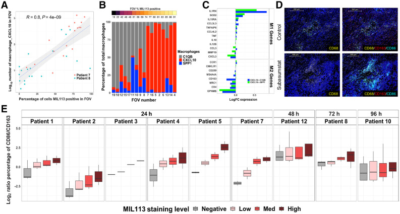 Figure 4. Subasumstat induces an increase in proinflammatory CXCL10-expressing macrophages in the TME that exhibit a shift in polarization state from M2 to M1. A, Correlation of number of Macrophage_CXCL10 cells (log10) to subasumstat drug target engagement measured by the percentage of cells MIL113-positive in each FOV. A linear model fit is shown with associated Pearson correlation, P value, as well as 95% confidence intervals (shaded). Note that the MIL113-staining data are from an adjacent section. B, The percentage of each of three macrophage populations in individual FOVS from patient 7. FOVs are ordered from left to right by increasing MIL113 positivity. Note that the MIL113 staining data are from an adjacent section. C, Differential expression of M1 and M2 genes in comparison of Macrophage CXCL10 with either Macrophage_C1QB or Macrophage_SPP1. Data are from both patients 7 and 8. D, Immunofluorescent staining for macrophages (CD68) and mIF staining for CD68/CD163/CD86 at regions of subasumstat drug target engagement (TAK-981) and regions of no subasumstat drug target engagement (control) from patient 7. CIVO GLO tracking microspheres shown in green; scale bar, 500 μm. E, M1/M2 ratio for each patient sample shown as log2 of the ratio of the percentage of CD86+ cells to the percentage of CD163 cells. Box plot represents the distribution and the median value of multiple tumor sections taken from different tumor regions within each patient and analyzed for response to subasumstat target engagement. Note that only one section from patient 3 was available for this analysis.