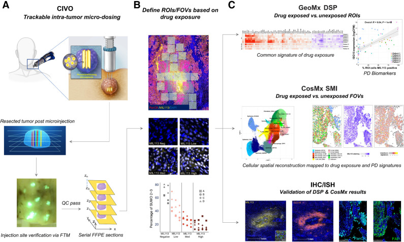 Figure 1. CIVO + GeoMx + CosMx Workflow. A, Drugs are delivered intratumorally in a columnar fashion to spatially defined positions in head and neck tumors using the CIVO microinjector. The position of each site of drug injection is identified and tracked from the initial injection procedure, through surgical resection, and ultimately spatial profiling by co-injection of fluorescent-tracking microspheres (FTM). Following incubation for 4 to 96 hours in the living intact tumor, the tumor is surgically resected and cross-sectioned perpendicular to the injection column plane. Tumors exhibiting distinct injection sites, as visualized by the presence of the FTM (fluorescent green in appearance) and verified as located in tumor tissue are processed as formalin-fixed, paraffin-embedded (FFPE) sections for downstream analysis via spatial profiling technologies and conventional IHC/ISH assays. B, Regions from FFPE sections containing trackable sites of drug target engagement are analyzed using GeoMx Digital Spatial Profiling RNA assays. Identification of localized regions of target engagement was enhanced by staining with the MIL113 antibody that specifically recognizes formation of subasumstat-SUMO adducts (yellow) and verified for inhibition of the SUMO pathway using an antibody specific for SUMO 2+3. To establish drug-induced responses across a compositionally diverse TME, multiple regions of interest (ROI) are placed at sites within and outside of graded areas of MIL113 staining (from high to low surrounding the FTM) for transcriptional profiling using probe sets such as the Cancer Transcriptome Atlas (1,800+ gene targets). C, Differential gene expression analysis was performed to determine drug-specific gene expression signatures across the patient tumor sample set. Similarly, regions within CIVO microdosed tumors can be analyzed using spatial molecular imaging such as Nanostring's CosMx technology. Gene expression at the cellular level is determined through iterative ISH and imaging for up to 1,000 gene targets. Segmented cells are assigned to cell types and cell type–specific expression levels can be compared at the cellular level within the spatial context of the intact TME. Drug-induced changes in transcript expression, detected by either DSP or SMI, are then validated at each spatially defined position of drug exposure within the TME by conventional IHC or ISH.