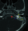 Fig. 4