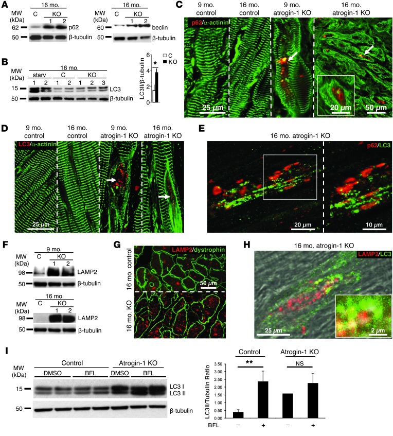 Atrogin-1 deficiency promotes cardiomyopathy and premature death via ...