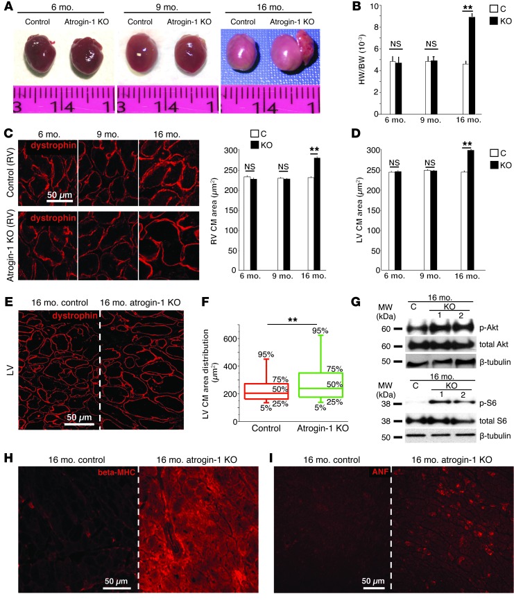 Atrogin-1 deficiency promotes cardiomyopathy and premature death via ...