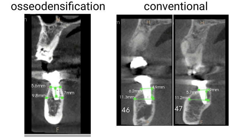 Figure 5