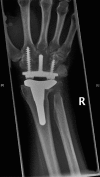 Fig. (3)