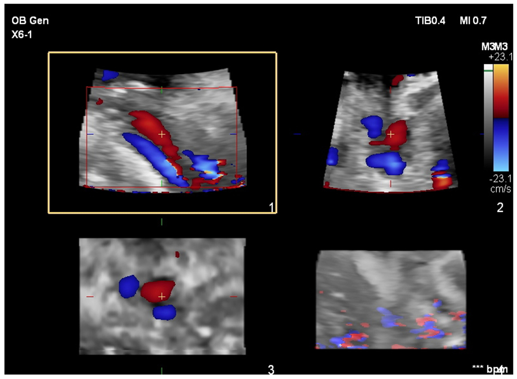 Fig. 1