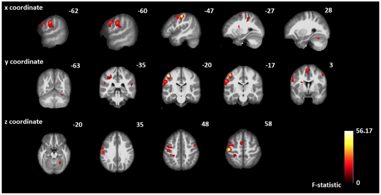 Fig 3