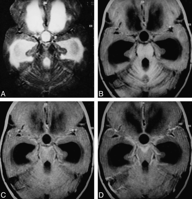 fig 4.