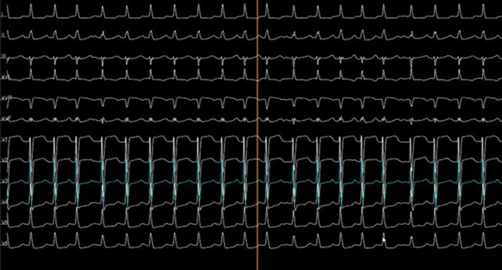 FIGURE 1