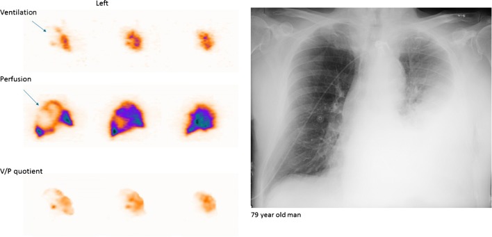 Fig. 10