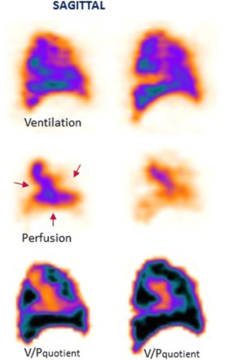 Fig. 11