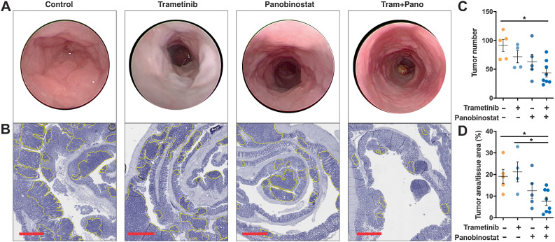 Figure 2. Combined MEK/HDAC inhibition attenuates colonic adenoma formation. A, Representative endoscopy images of control and drug-treated mice obtained immediately before the experimental endpoint. Mice were treated with trametinib (0.3 mg/kg), panobinostat (5 mg/kg) or the combination for five consecutive days followed by 2 days of rest and received a total of 12 treatments. B, Representative hematoxylin and eosin (H&E) stains of the entire colon from mice treated with vehicle control, trametinib, panobinostat or trametinib plus panobinostat. Yellow outlining indicates tumors; scale bar, 900 μm. C, Tumor number obtained from macroscopic counting of adenomas in resected colons. D, Tumor burden as determined by computing total tumor area relative to total tissue area from H&E-stained sections of the entire colon, from vehicle control (n = 5), trametinib (n = 4), panobinostat (n = 5), and combination (n = 8) treated mice. The values shown are mean ± SEM from the biological replicates. One-way ANOVA, with Tukey's multiple comparison testing; *, P ≤ 0.05; ***, P ≤ 0.001.