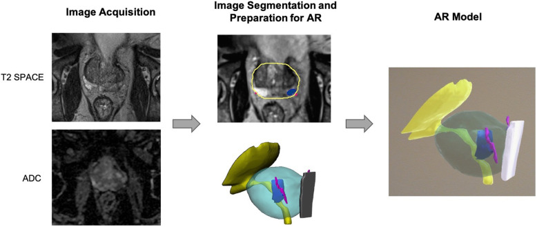 Fig. 11