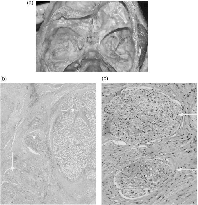 Fig. 4.