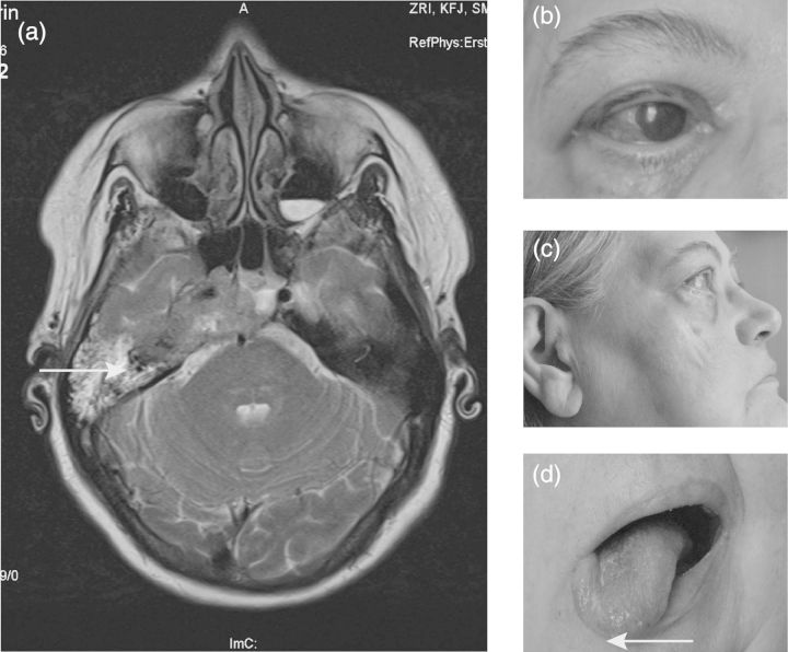 Fig. 2.