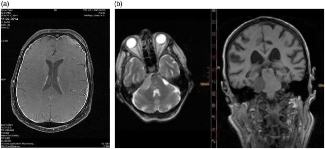 Fig. 1.