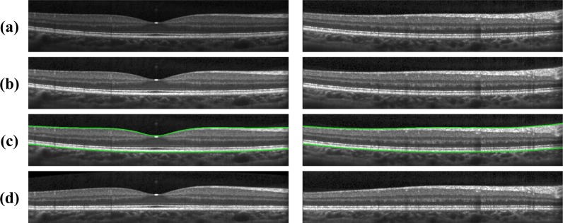 Fig. 3