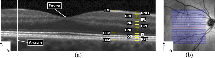 Fig. 1