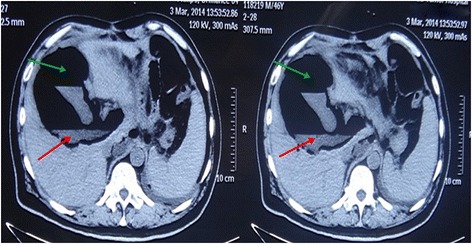 Fig. 2