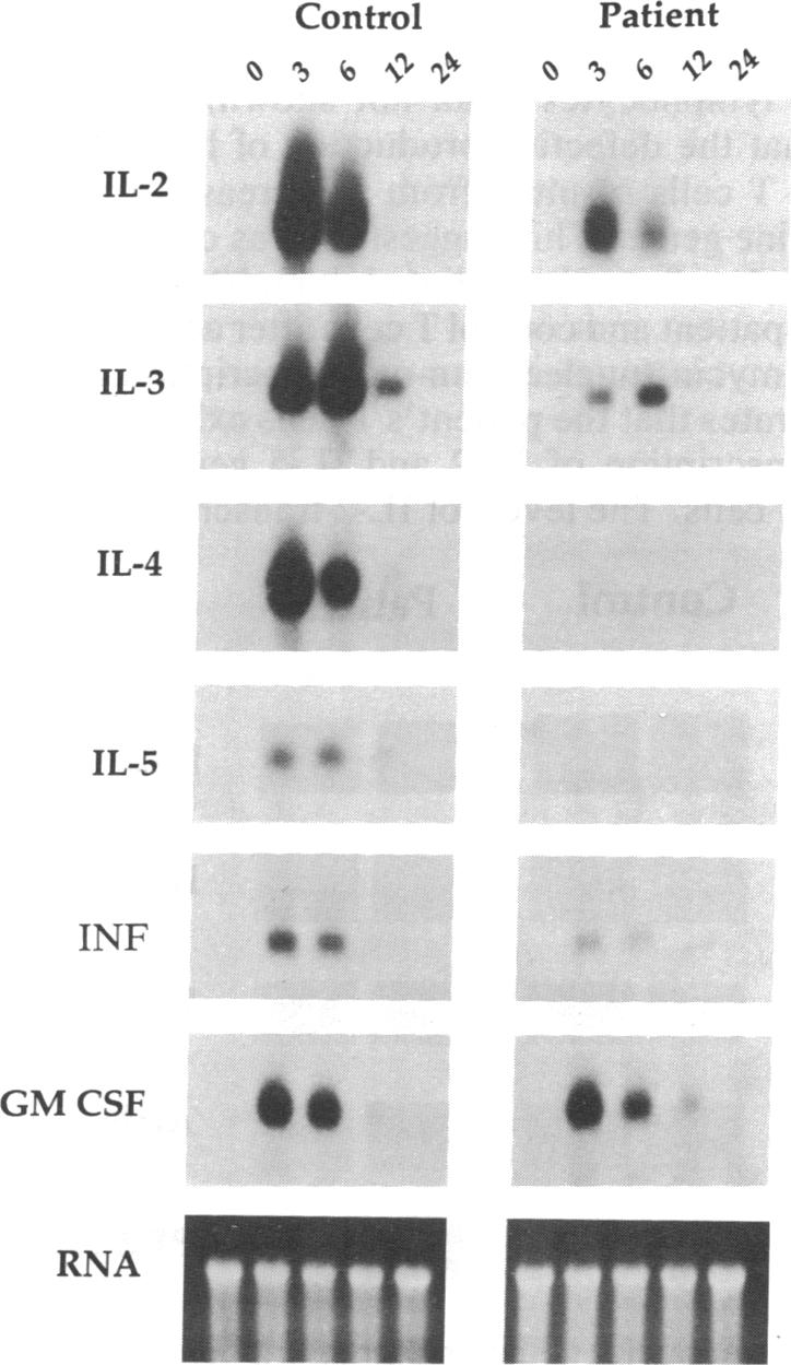 graphic file with name pnas01049-0537-a.jpg