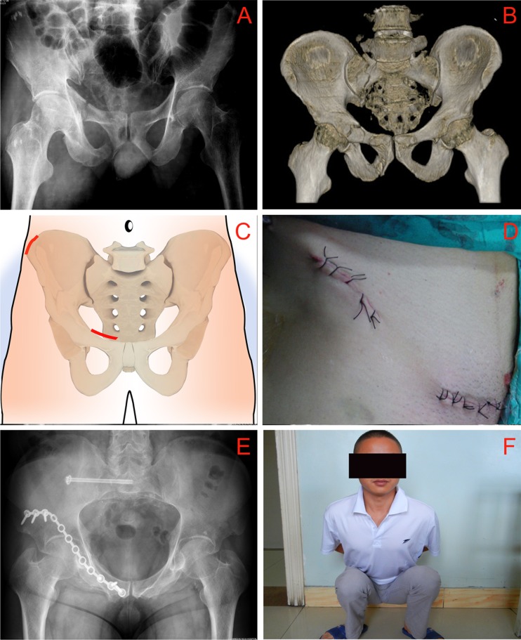 Fig. 1