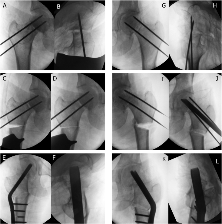 Fig. 2