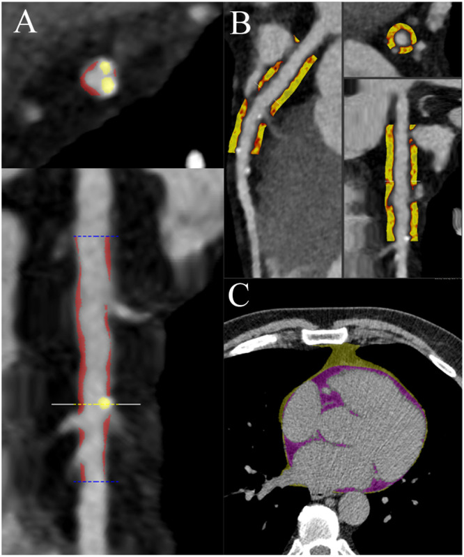 Fig 2