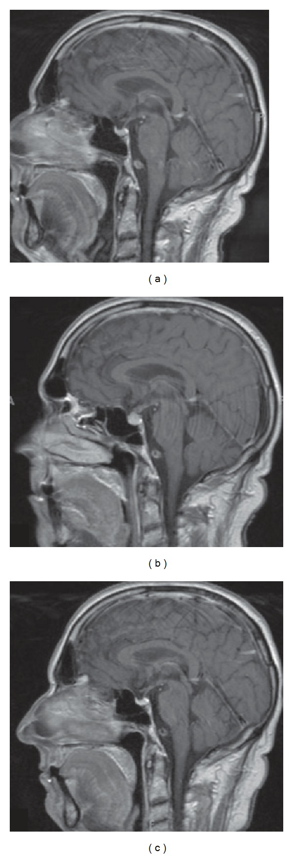 Figure 7