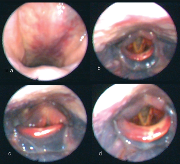 Figure 1: