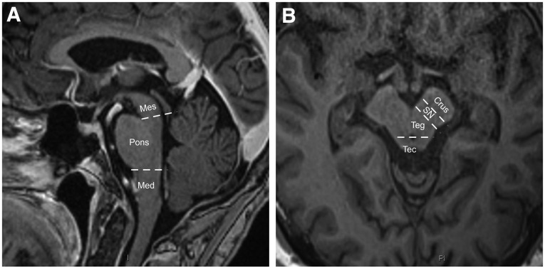 FIG. 1.