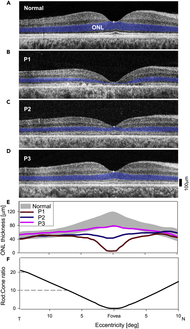 Figure 2