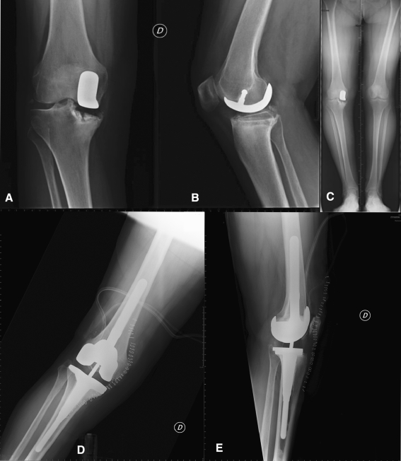 Fig. 4A–E