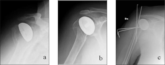 Figure 1 a, b, c