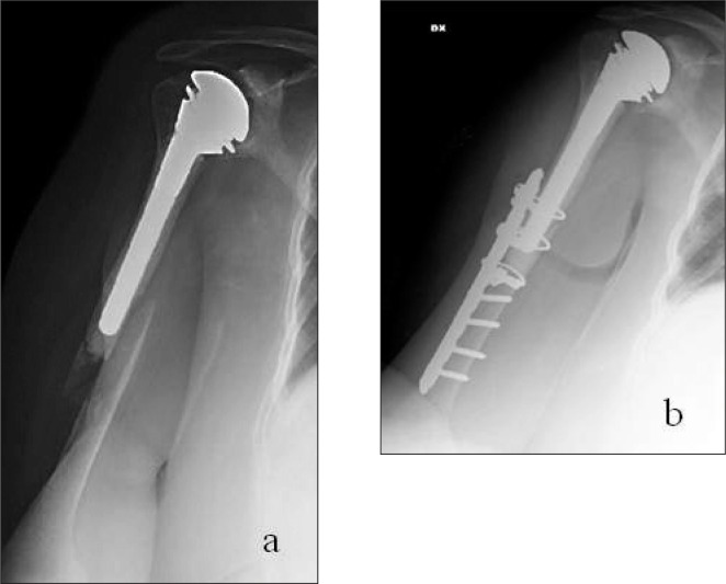 Figure 4 a, b