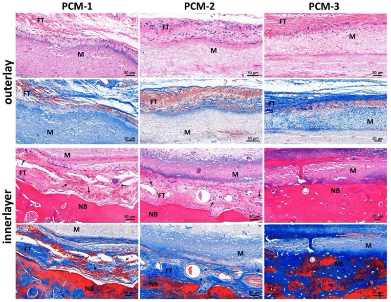 Figure 11.