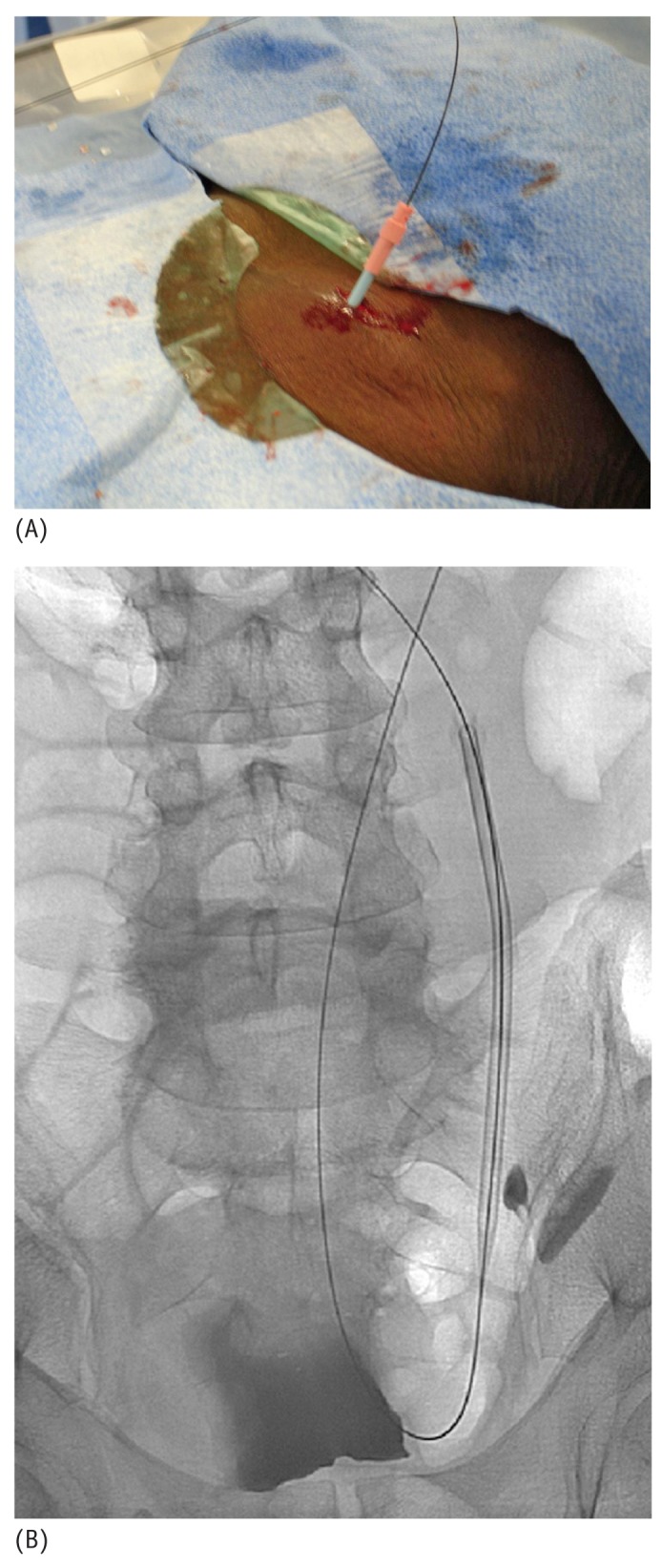 Figure 11 —