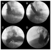 Fig. 4