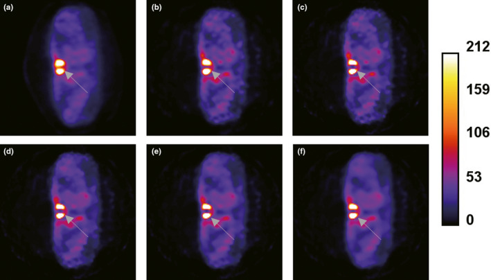 Figure 10