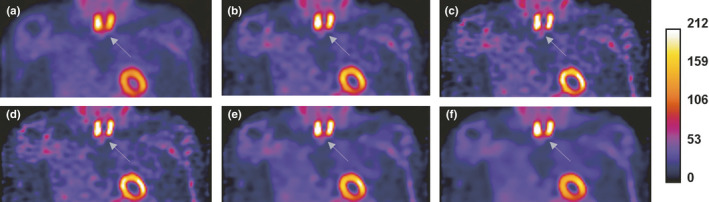 Figure 11