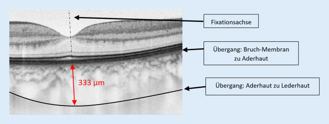 graphic file with name 347_2021_1427_Fig1_HTML.jpg