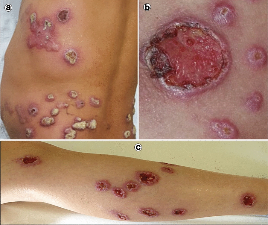 Fig. 3
